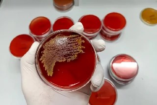 Curso gratuito de Básico em Bacteriologia Clínica